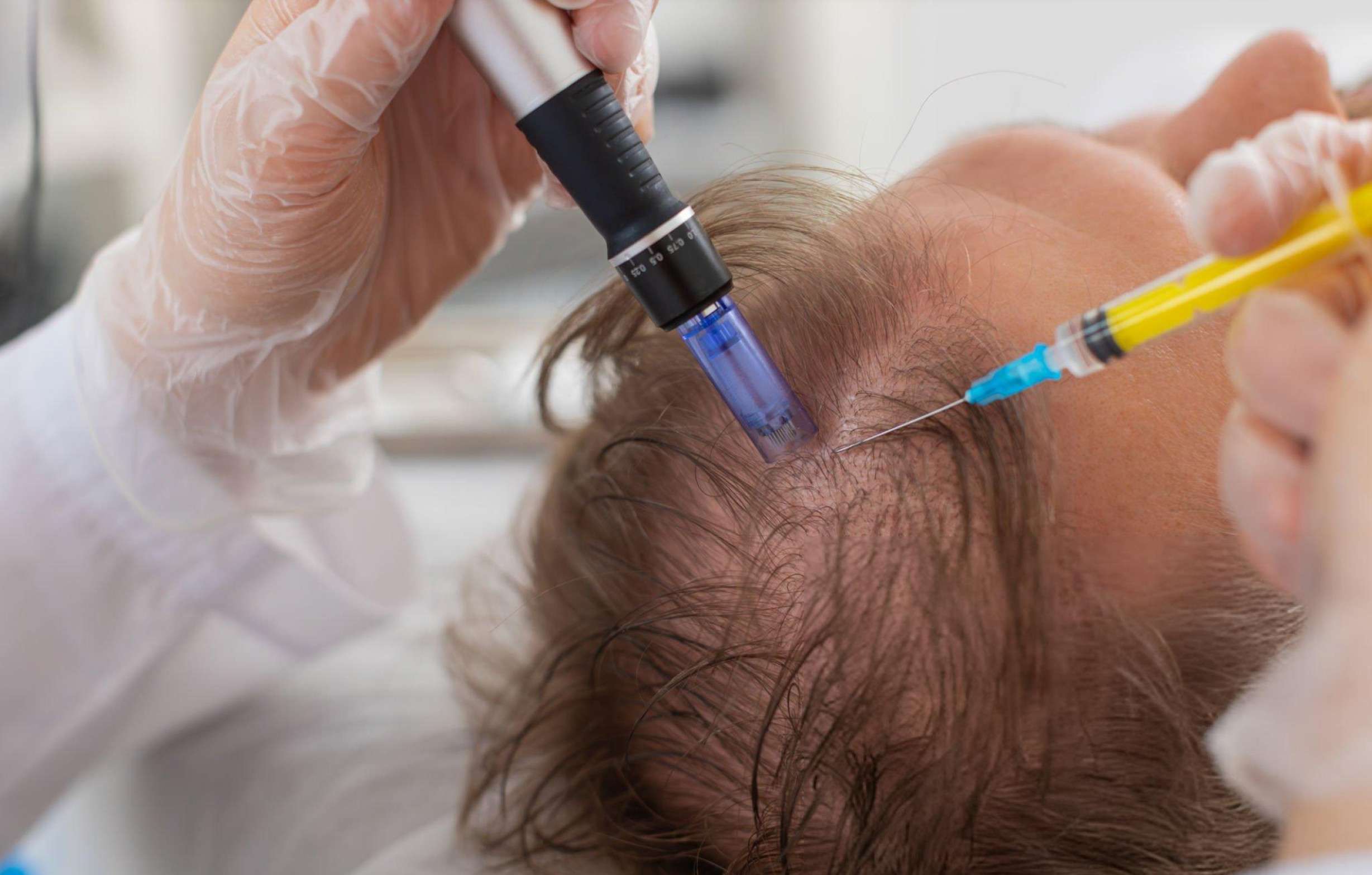 Exosome therapy results